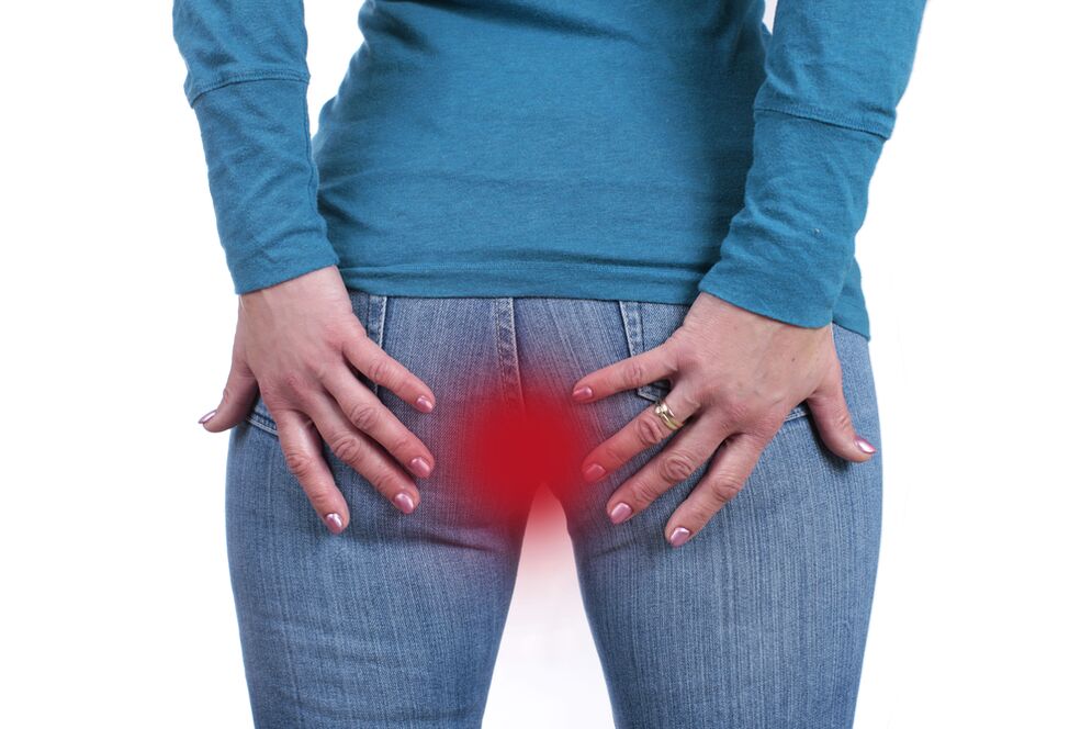 Symptome von Hämorrhoiden
